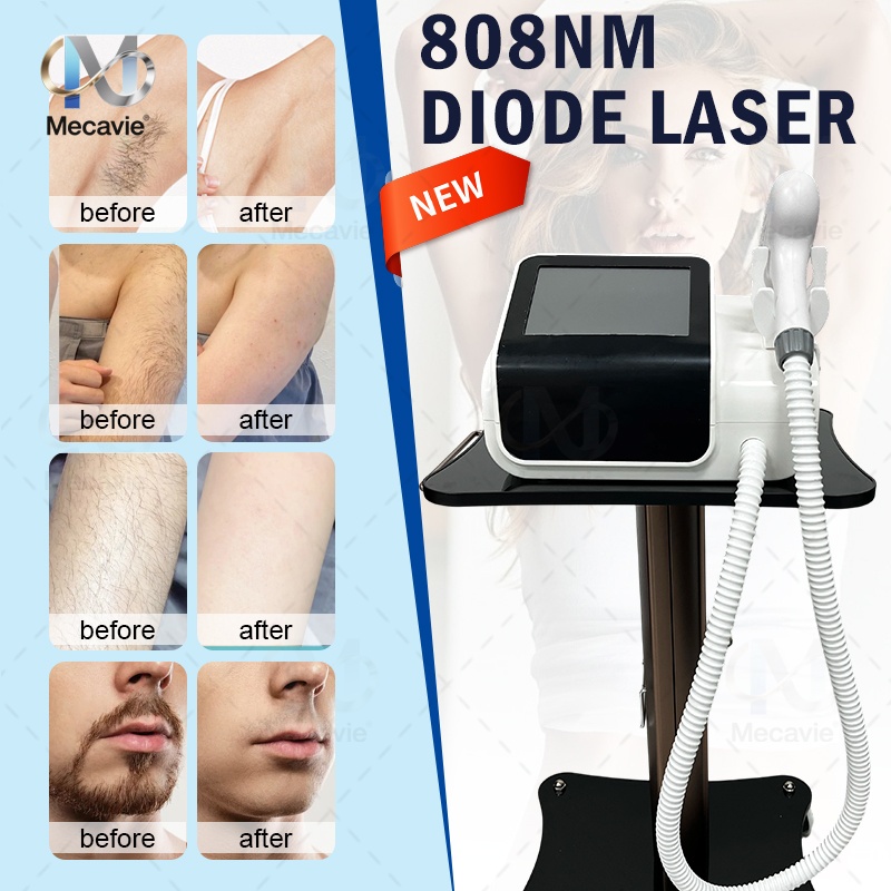 Industrial Laser Hair Removal Machine - Nowe urządzenie do depilacji diodowej Mini