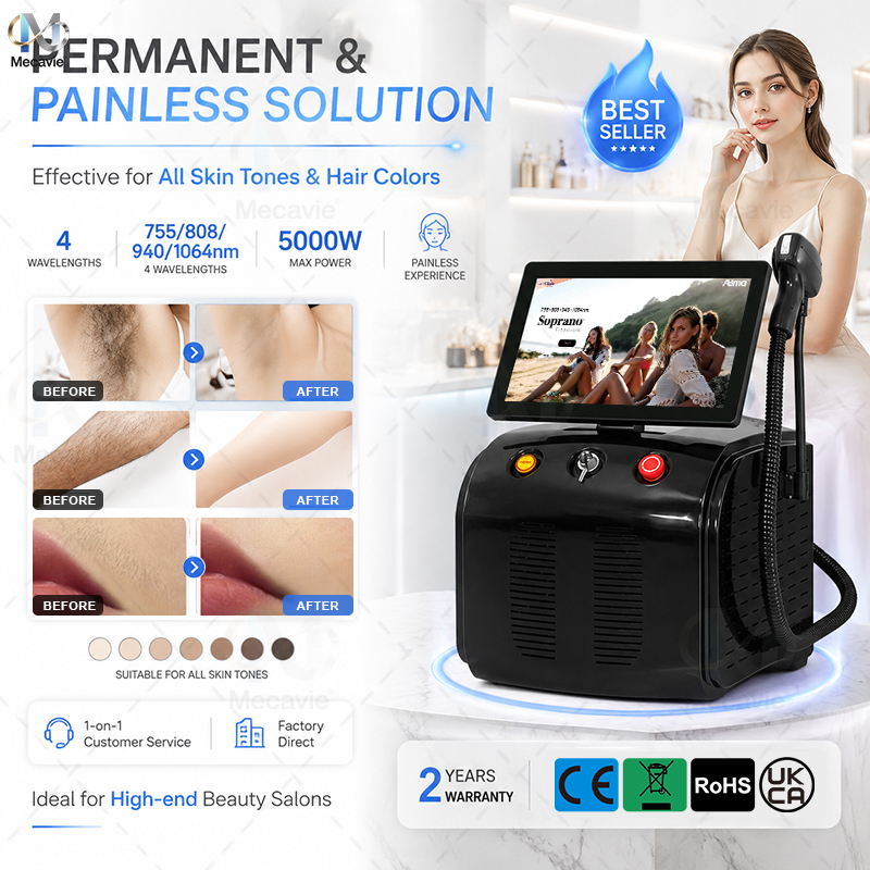 Przenośny laser diodowy Sopran – Industrial Laser Hair Removal Machine recenzja i cena